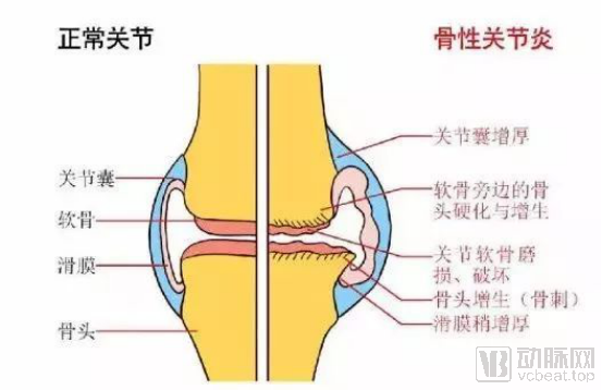 leyu.体育(中国)官方网站聚乙烯材料什么是聚乙烯材料？聚乙烯材料的最新报道(图4)